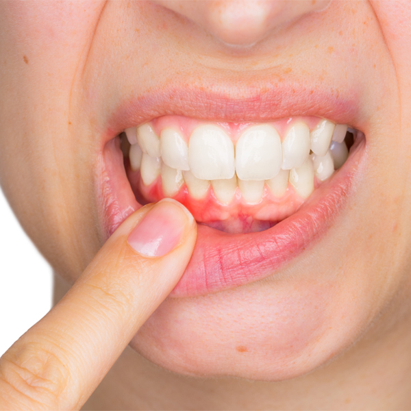 periodoncia en la clínica dental