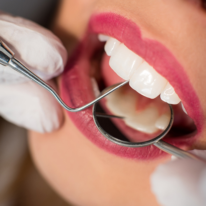 cirugía oral clinica dental