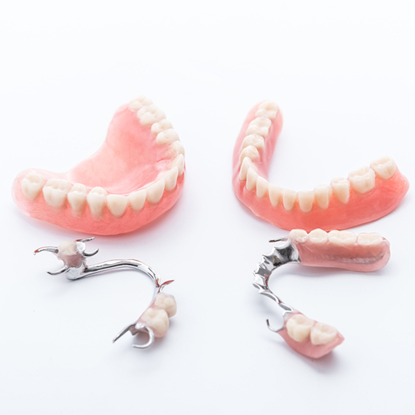 dentista-dentaruras fijas y parciales